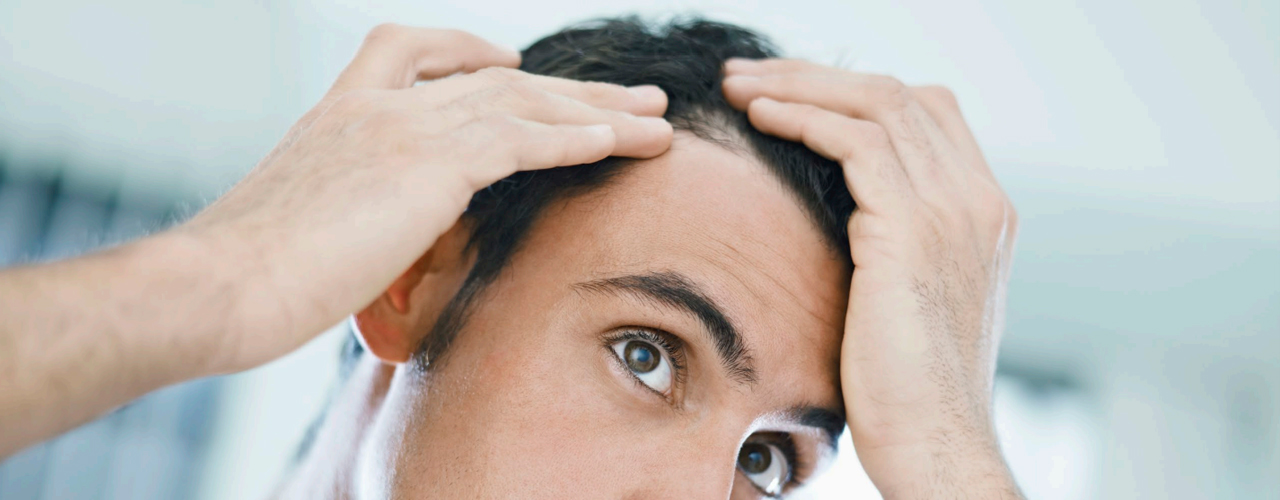 Was ist eine Haartransplantation?