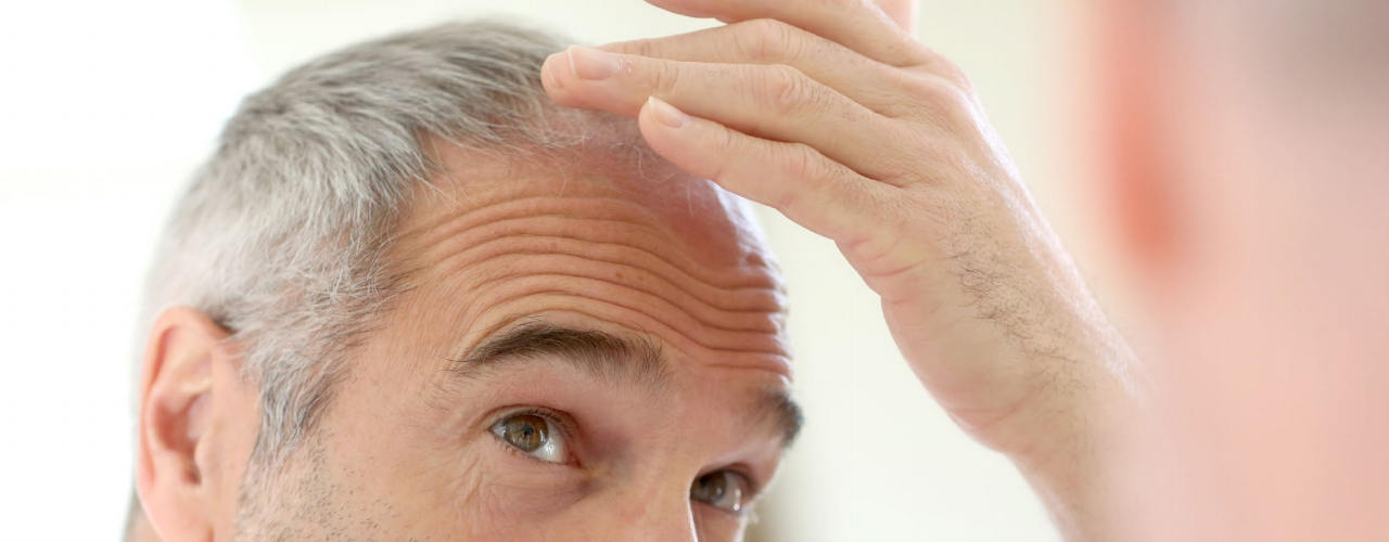 Was sind die Ursachen für Haarausfall?