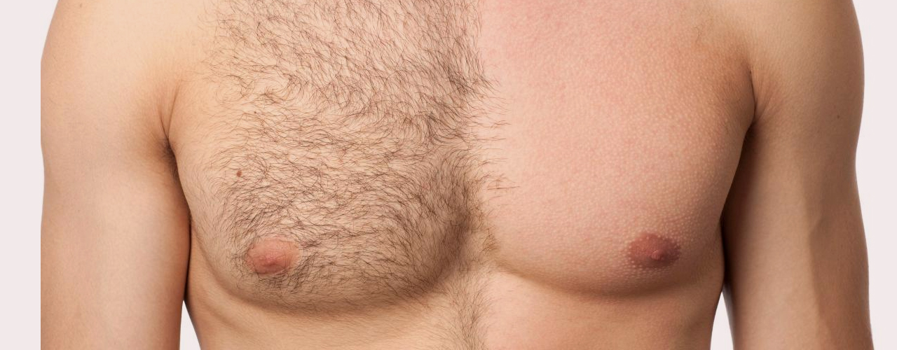 İst eine Haartransplantation durch Körperhaare möglich?