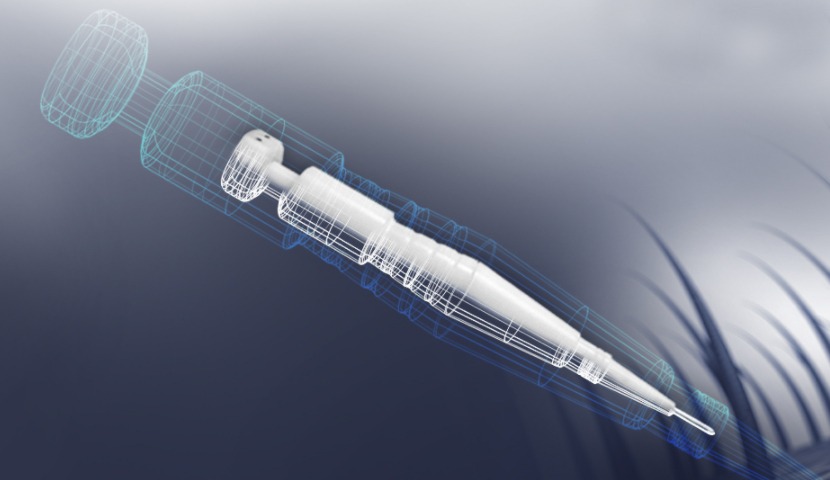 Choi (Pen-Technik) Haartransplantation